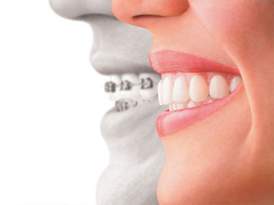 Claro Dental | Extractions, Dental X-Rays and All-on-4 reg 