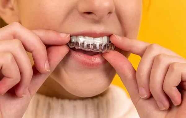 Claro Dental | Family Dental Care, Oral Exams and Invisalign reg 